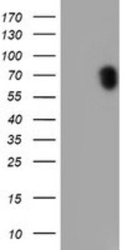 p70 S6 Kinase/S6K Antibody (OTI1G4), Novus Biologicals 0.1mL; Unlabeled:Antibodies,