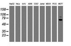 p70 S6 Kinase/S6K Antibody (OTI1G4), Novus Biologicals 0.1mL; Unlabeled:Antibodies,