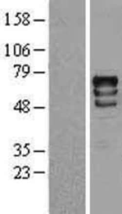 Novus Biologicals&trade;&nbsp;p70 S6 Kinase/S6K Overexpression Lysate