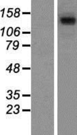 Novus Biologicals&trade;&nbsp;SA1 Overexpression Lysate
