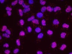 SA1 Antibody, Novus Biologicals 0.1mL; Unlabeled:Antibodies, Polyclonal