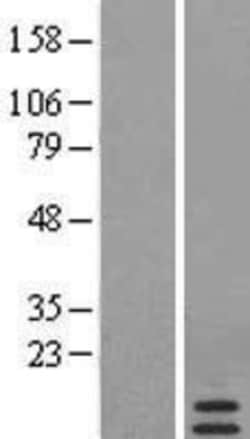 Novus Biologicals™ Serum Amyloid A4 Overexpression Lysate