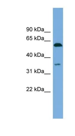 SAAL1 Antibody, Novus Biologicals 100&mu;L; Unlabeled:Antibodies, Polyclonal