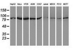 SAE2 Antibody (OTI4A3), Novus Biologicals 0.1 mL | Buy Online | Novus Biologicals | Fisher Scientific