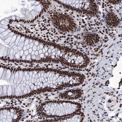 SAE2 Antibody, Novus Biologicals 0.1mL; Unlabeled:Antibodies, Polyclonal