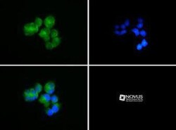 SAH3 Antibody, Novus Biologicals 0.1mg; Unlabeled:Antibodies, Polyclonal