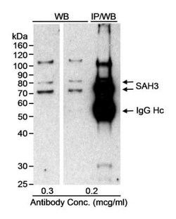 SAH3 Antibody, Novus Biologicals 0.1mg; Unlabeled:Antibodies, Polyclonal
