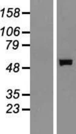 Novus Biologicals Salivary Amylase Alpha Overexpression Lysate 0.1 mg | Buy Online | Novus Biologicals&trade; | Fisher Scientific