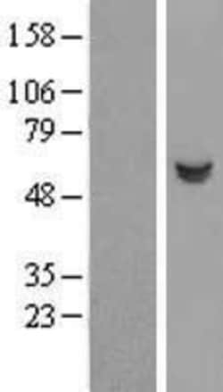 Novus Biologicals&trade;&nbsp;Salivary Amylase Alpha Overexpression Lysate