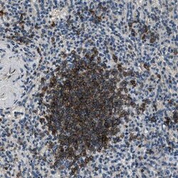 SALL3 Antibody, Novus Biologicals 0.1mL; Unlabeled:Antibodies, Polyclonal