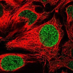 SALL4 Antibody, Novus Biologicals:Antibodies:Primary Antibodies