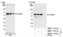 SAM68 Antibody, Novus Biologicals 0.1mL; Unlabeled:Antibodies, Polyclonal