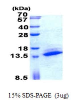 Novus Biologicals&trade;&nbsp;Recombinant Human SAMD13 His Protein