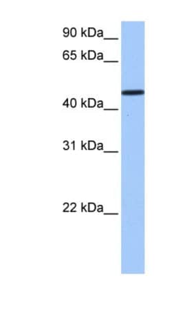 SAMD14 Antibody, Novus Biologicals:Antibodies:Primary Antibodies