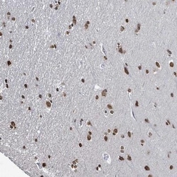 SAMD14 Antibody, Novus Biologicals:Antibodies:Primary Antibodies