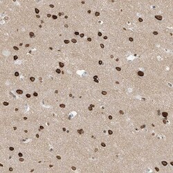 SAMD15 Antibody, Novus Biologicals 25 &mu;L | Buy Online | Novus Biologicals | Fisher Scientific