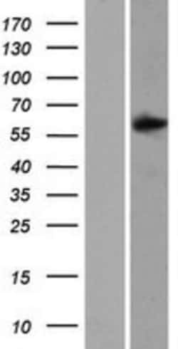 Novus Biologicals™ SAMD3 Overexpression Lysate