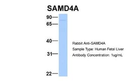 SAMD4A Antibody, Novus Biologicals 0.05mg; Unlabeled:Antibodies, Polyclonal