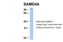 SAMD4A Antibody, Novus Biologicals 0.05mg; Unlabeled:Antibodies, Polyclonal