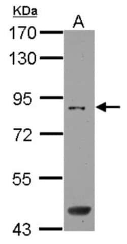 SAMD4B Antibody, Novus Biologicals 0.1mL; Unlabeled:Antibodies, Polyclonal