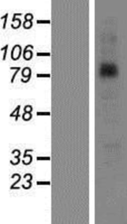 Novus Biologicals&trade;&nbsp;SAMD4B Overexpression Lysate