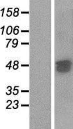 Novus Biologicals&trade;&nbsp;SAMD7 Overexpression Lysate