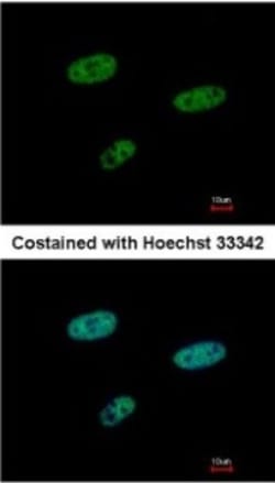 SAMHD1 Antibody, Novus Biologicals 0.1mL; Unlabeled:Antibodies, Polyclonal