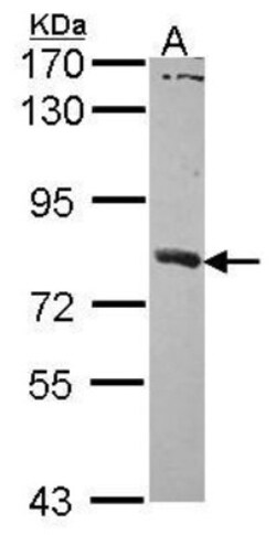 SAMHD1 Antibody, Novus Biologicals 0.1mL; Unlabeled:Antibodies, Polyclonal