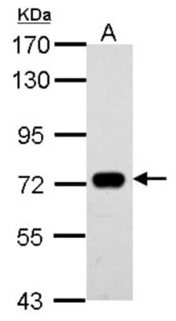 SAMHD1 Antibody, Novus Biologicals 0.1mL; Unlabeled:Antibodies, Polyclonal