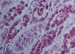 SAMHD1 Antibody, Novus Biologicals:Antibodies:Primary Antibodies