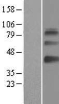 Novus Biologicals&trade;&nbsp;SAMSN1 Overexpression Lysate