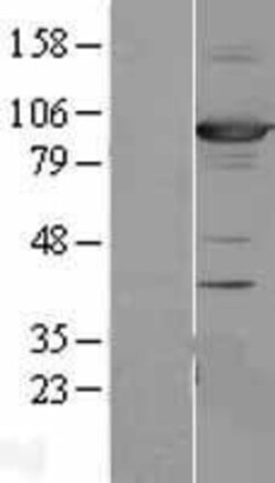 Novus Biologicals&trade;&nbsp;SAP102 Overexpression Lysate