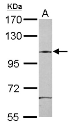 SAP130 Antibody, Novus Biologicals 0.1mL; Unlabeled:Antikörper