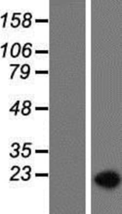 Novus Biologicals&trade;&nbsp;SAP155 Overexpression Lysate