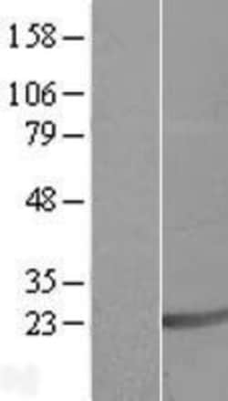 Novus Biologicals&trade;&nbsp;SAP18 Overexpression Lysate