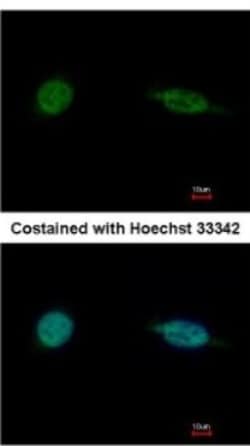 SAP30BP Antibody, Novus Biologicals 0.1mL; Unlabeled:Antibodies, Polyclonal
