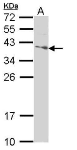 SAP30BP Antibody, Novus Biologicals 0.1mL; Unlabeled:Antibodies, Polyclonal
