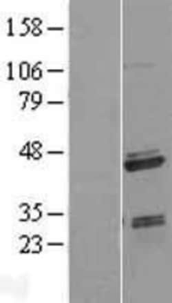 Novus Biologicals&trade;&nbsp;SAP30BP Overexpression Lysate