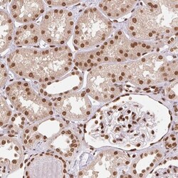 SAP30BP Antibody, Novus Biologicals 0.1mL; Unlabeled:Antibodies, Polyclonal
