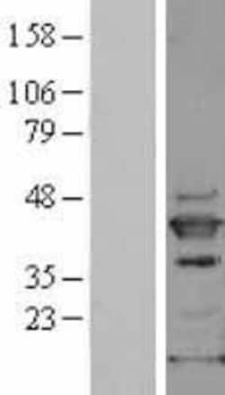 Novus Biologicals&trade;&nbsp;p38 delta/SAPK4 Overexpression Lysate