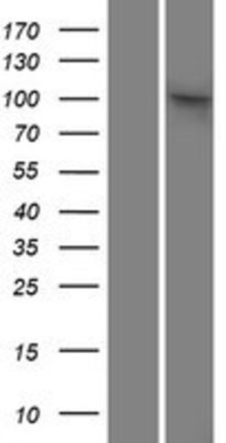 Novus Biologicals&trade;&nbsp;SAPS2 Overexpression Lysate