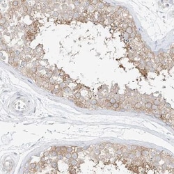 SAPS2 Antibody, Novus Biologicals 25 &mu;L; Unlabeled:Antibodies, Polyclonal