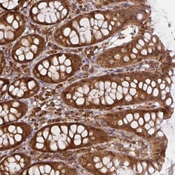 SAPS3 Antibody, Novus Biologicals 0.1mL; Unlabeled:Antibodies, Polyclonal