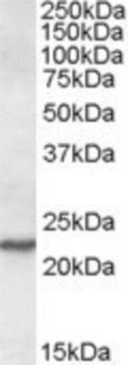SAR1 Antibody, Novus Biologicals 0.1mg; Unlabeled:Antibodies, Polyclonal