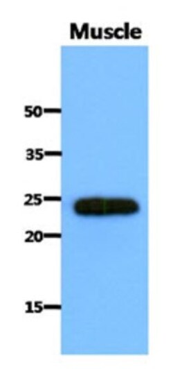 SAR1B Antibody (1C7) - BSA Free, Novus Biologicals 0.1mL; Unlabeled:Antibodies,