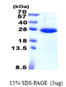Novus Biologicals&trade;&nbsp;Recombinant Human SAR1B His Protein
