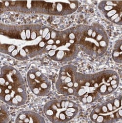 SAR1B Antibody, Novus Biologicals 0.1mL; Unlabeled:Antibodies, Polyclonal