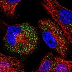 Sarcalumenin Antibody, Novus Biologicals:Antibodies:Primary Antibodies