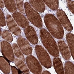 Sarcalumenin Antibody, Novus Biologicals:Antibodies:Primary Antibodies