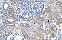 SARDH Antibody, Novus Biologicals 0.1mg; Unlabeled:Antibodies, Polyclonal